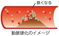 図：動脈硬化のイメージ